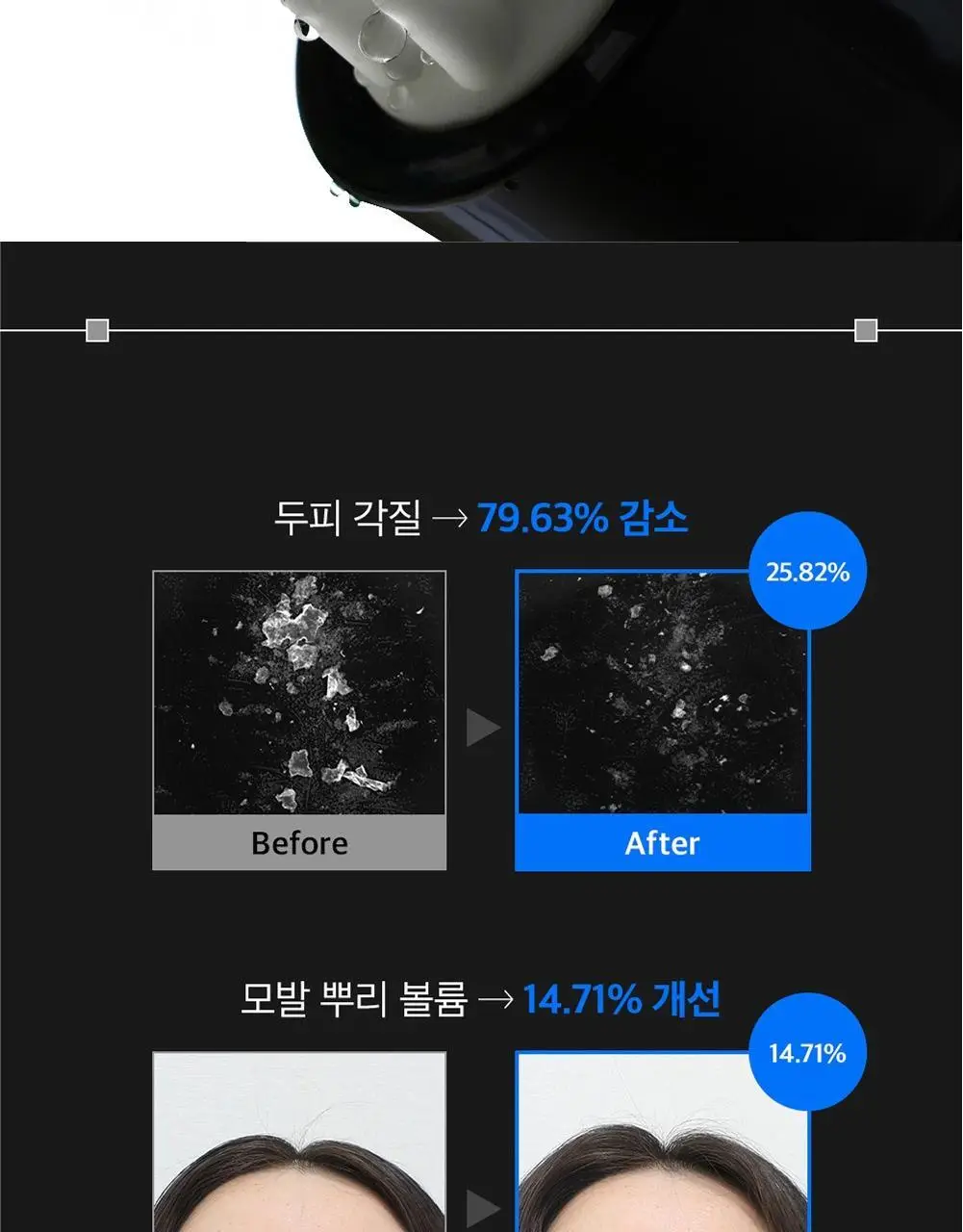 [탈모증상개선] 리필드 사이토카인 부스터 프로 70ml 단품/기획 2종 택1 상세페이지 17